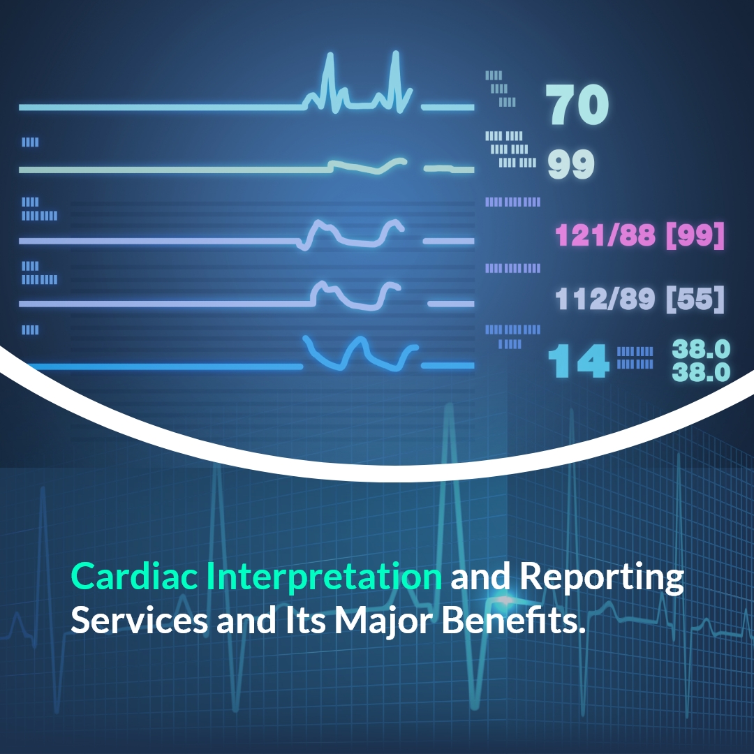 Cardiac Interpretation And Reporting Services And Its Major Benefits 